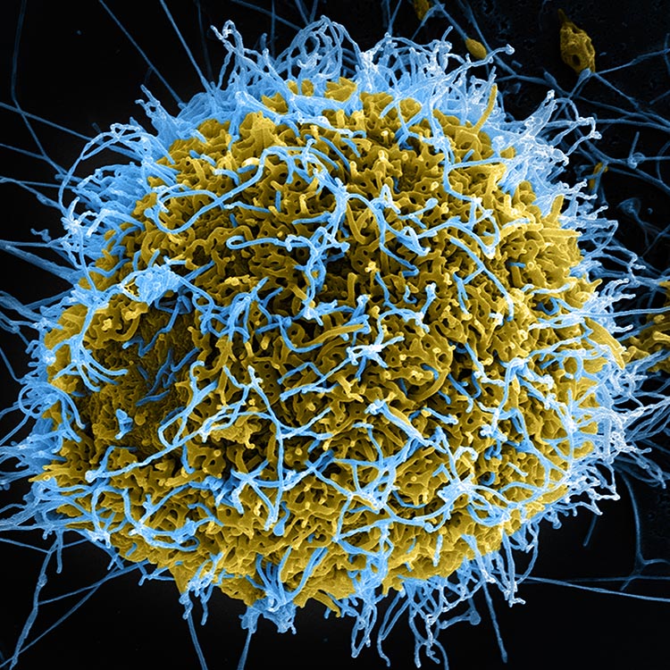 Ebola virus budding from Vero cell