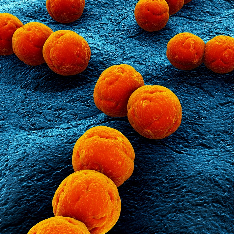 Orange balls of Streptococcus bacteria.