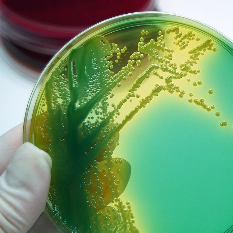 Gloved hand holding petri dish containing green agar and bacteria cultures.