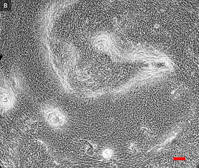 Gray and white primary bronchial cells, day 21.