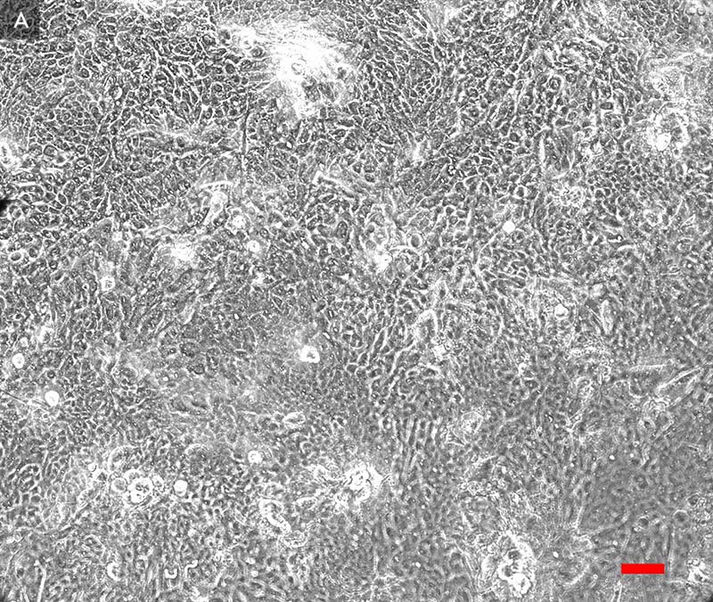 Gray and white primary bronchial cells, day 6.