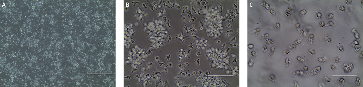 Mature dendrites form over time in images A, B, C.