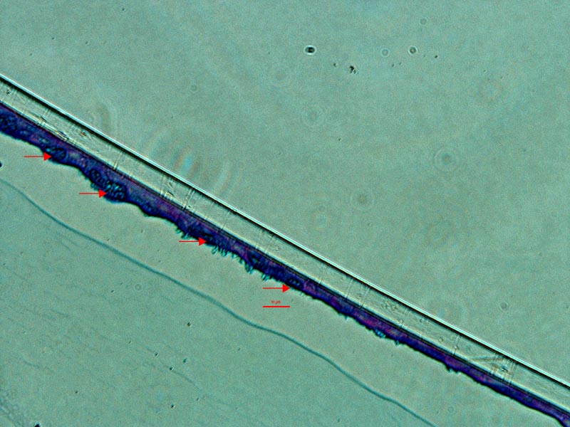 Blue-purple lines of primary human bronchial/tracheal epithelial cells.