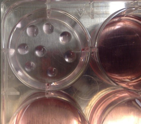 Appearance of properly dispensed CellMatrix domes. One well of a 6-well plate containing eight cell matrix domes after polymerization and before overlay with medium