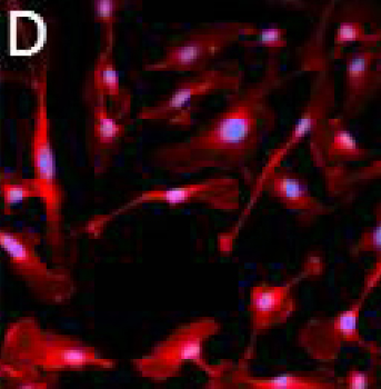 Figure D - Telomerase-immortalized Microvascular Endothelial Cells