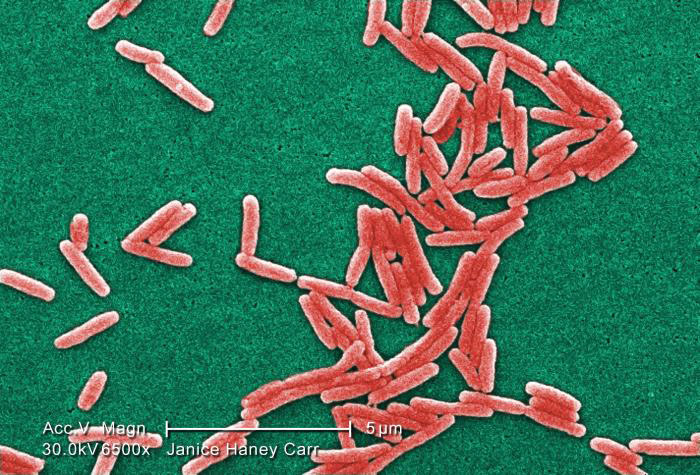 Image of Gram-negative Legionella pneumophila bacteria