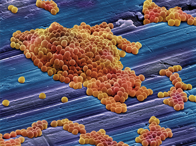 Image of MRSA