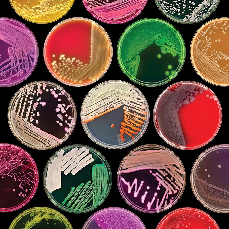 Bacterial growth on a variety of agar plates.