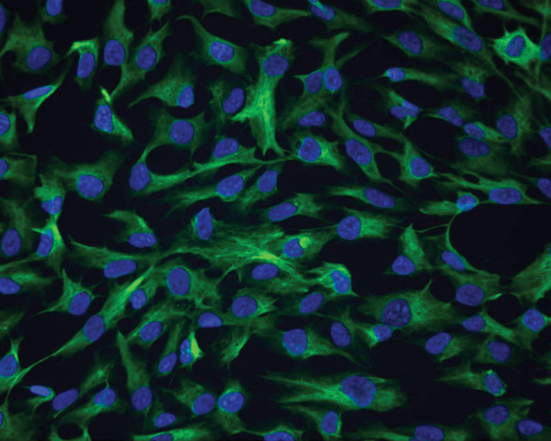 ATCC CRL-4000 stained with a monoclonal pan-cytokeratin antibody (green) and Hoechst dye (blue).