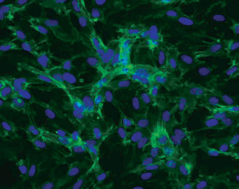 ATCC CRL-4025 stained with a CD31 antibody (green) and Hoechst dye (blue)