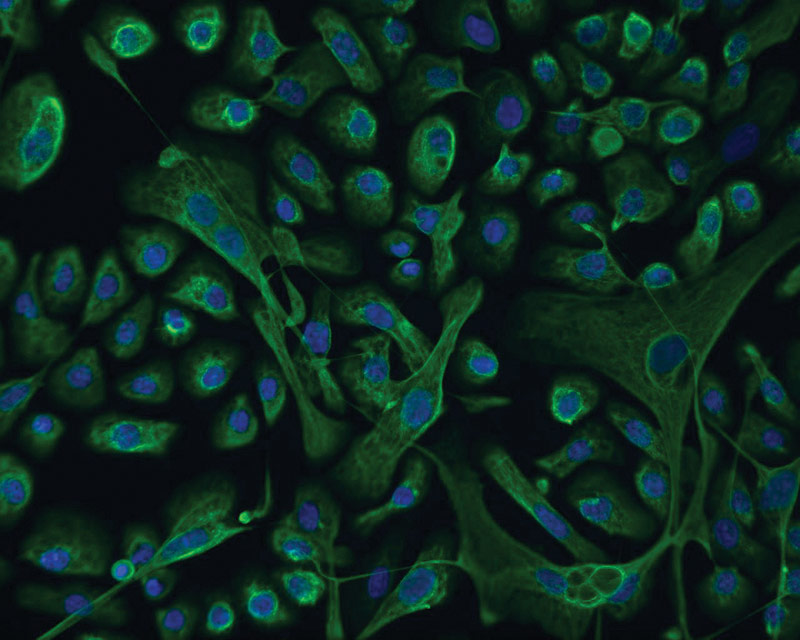 ATCC CRL-4027 stained with a monoclonal pan-cytokeratin antibody (green) and Hoechst dye (blue)