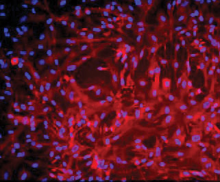 ATCC CRL-4023 stained with a monoclonal pan-cytokeratin antibody (red) and Hoechst dye (blue)