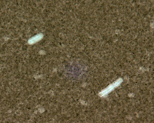 Capsule stain of Bacillus anthracis. Photo courtesy of Larry Stauffer  and CDC.