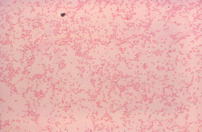 Gram stain of Brucella canis (Gram-negative). Photo courtesy of Dr.  WA Clark and CDC.
