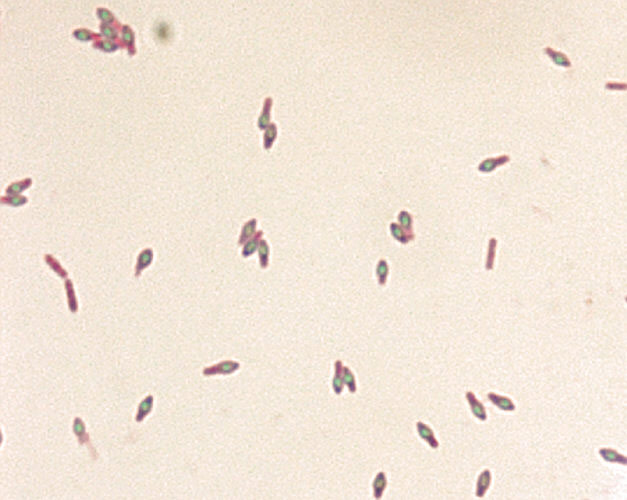 Endospore stain of Clostridium botulinum. Photo courtesy of Larry Stauffer and CDC