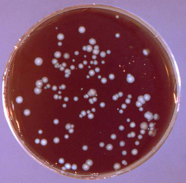 Example of a spread plate exhibiting isolated colonies of Legionella  pneumophilia following incubation. Photo courtesy of Dr. Jim  Feeley and CDC.