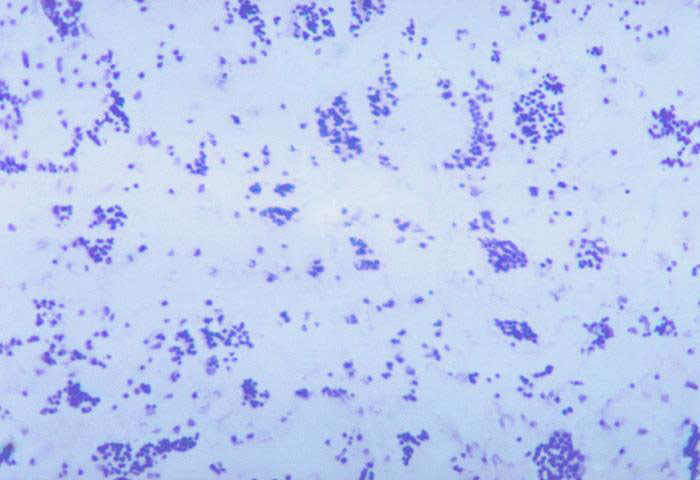 Simple stain of Francisella tularensis using methylene blue. Photo  courtesy of Dr. PB Smith and CDC.