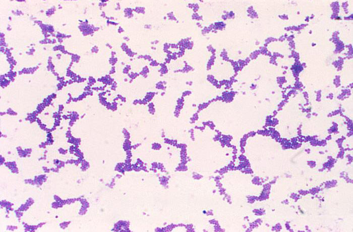 Gram stain of Staphylococcus aureus (Gram-positive). Photo  courtesy of Dr. Richard Facklam and CDC.