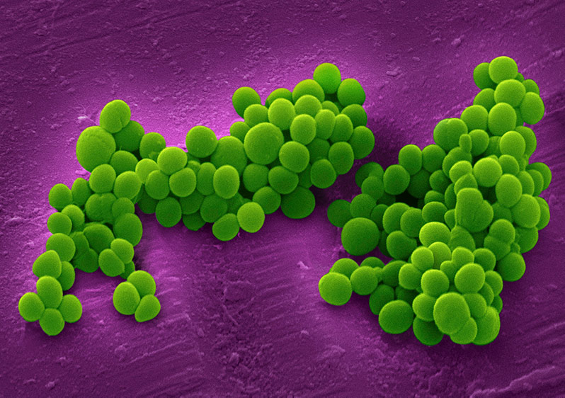 Staphylococcus aureus - cocci bacteria with staphylococci  arrangement