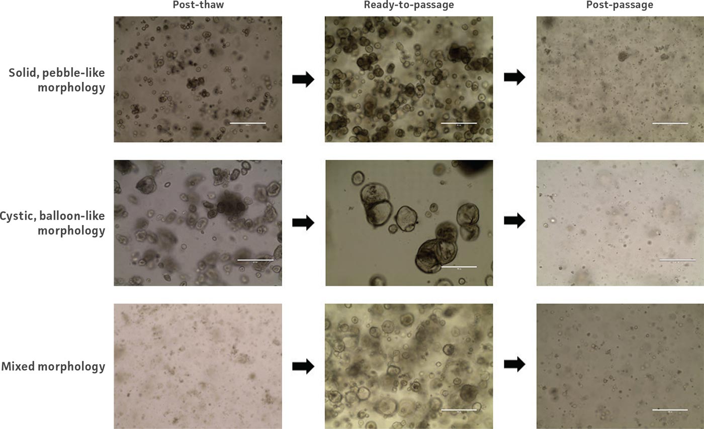 Example images of organoid model morphology during post-thaw, ready-to-passage, and post-passage stages of culture.