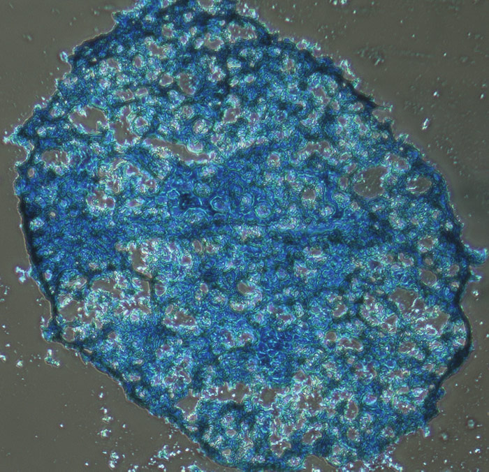Blue sphere of ATCC Adipose-derived Mesenchymal Stem Cells.