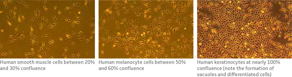 Levels of cellular confluence