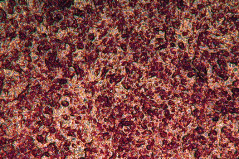 Adipocytes differentiated from Adipose-Derived Mesenchymal Stem Cells (PCS- 500-011) and stained with Oil Red O to detect the formation of lipid droplets.