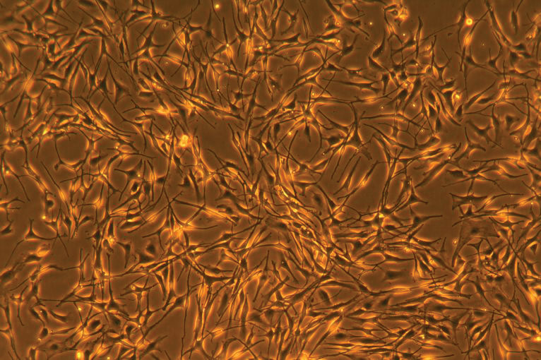 Orange, yellow, and brown adult human melanocyte cells.