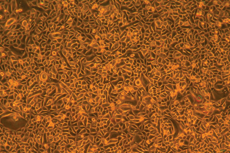 Orange and brown primary prostate epithelial cells.
