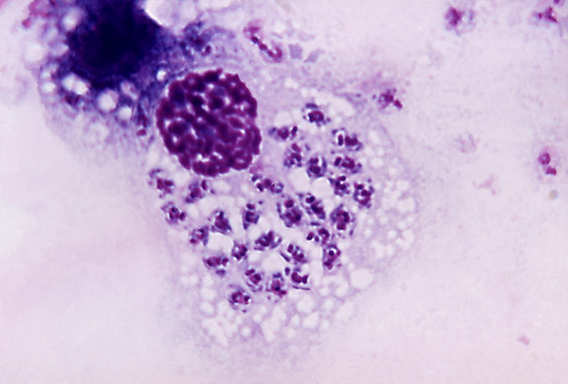 Trypanosoma cruzi.