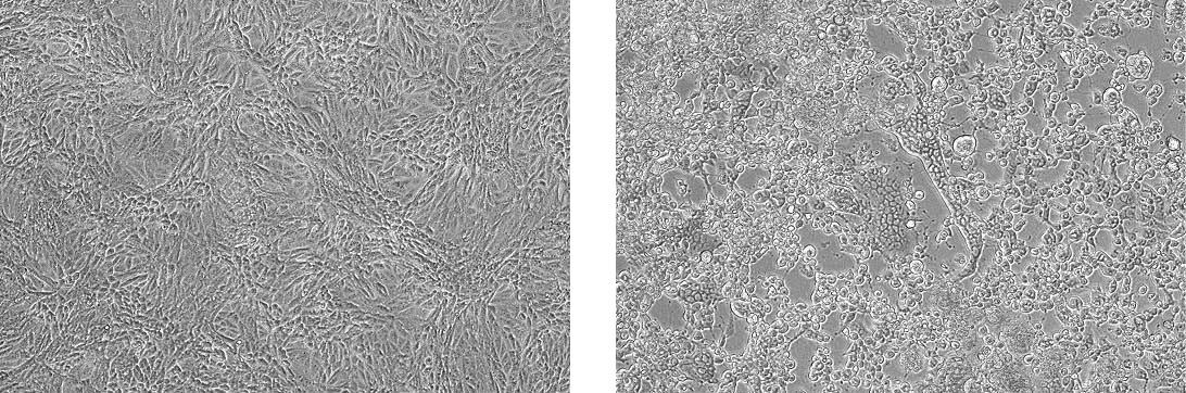 Two panels showing propagation of Human herpes virus 1 in Vero cells. The left panel depicts uninfected CCL-81 cells. The right panel depicts infected CCL-81 cells exhibiting CPE.