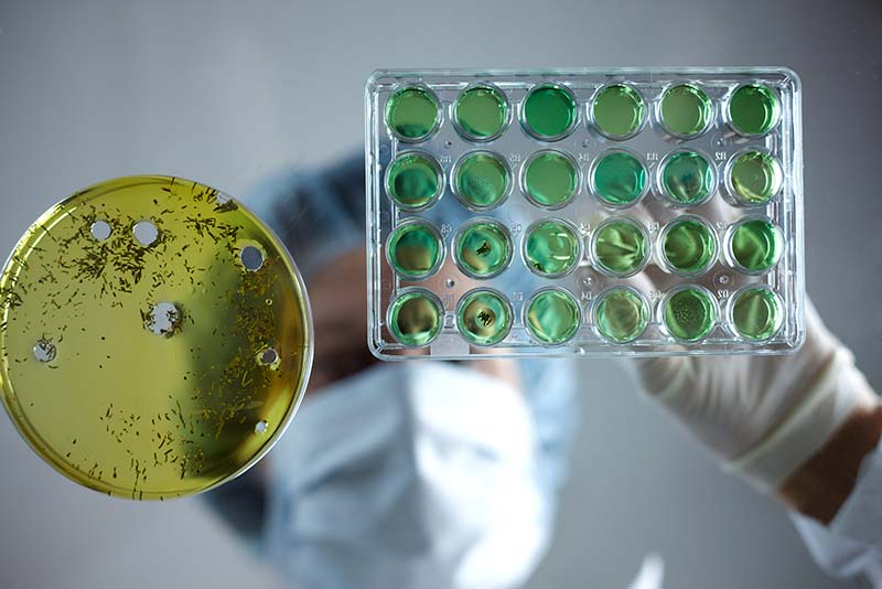 Underside view of person in gloves, mask and hair cover holding tweezers over petri dish containing yellow media and well plate containing green media.