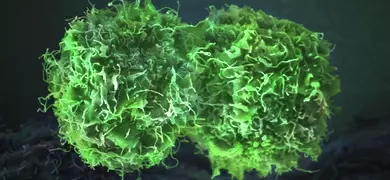 Round, green, lettuce-like skin cancer cells.
