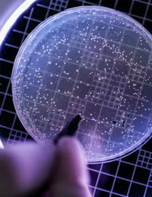 Looking at Petri Dish with Bacteria Culture through magnifying glass