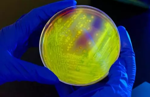 Blue-gloved hands holding a petri dish containing yellow clostridium difficile bacteria.
