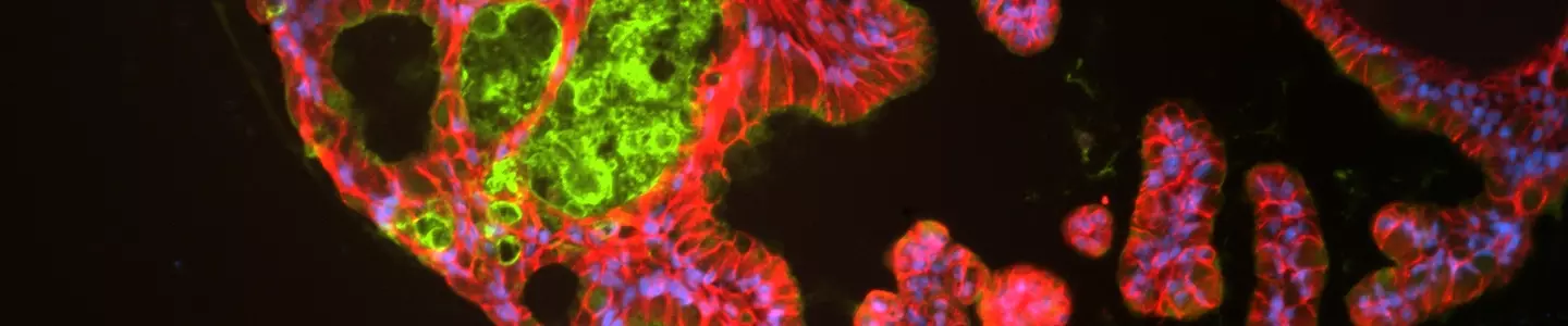 Fluorescent microscopy image of organoid cells stained in green, pink, and blue, highlighting distinct cellular components and structural features.