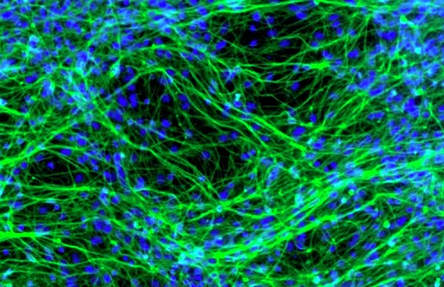 Neurons derived from human neural stem cells Credit Yirui Sun.