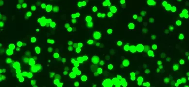 Green human embryonic kidney 293T-HEK cells.