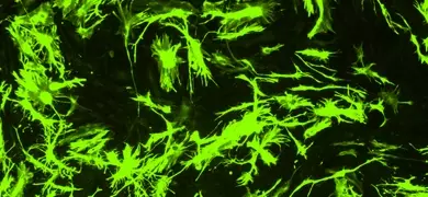 Fluorescent microscopy image showing green astrocyte neural progenitor cells with intricate branching structures on a dark background.