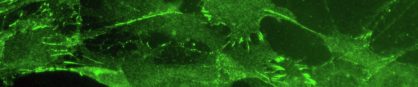 Loose Cadherin Adhesions in Cultured Melanoma Cells.jpg