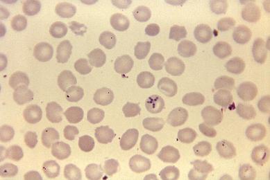 5944_lores Babesia sp. CDC Steven Glenn.jpg