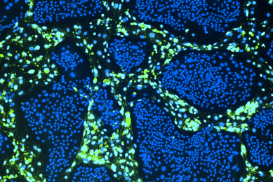  Green and blue conditionally reprogrammed organoid cells