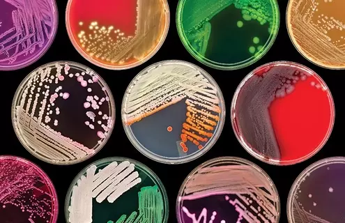 Multiple petri dishes in a variety of colors on a black background