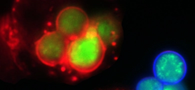 Green and red yeast with macrophage cells