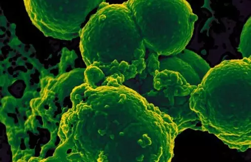 Digitally colorized, scanning electron microscopic (SEM) image, depicts a white blood cell (WBC) known as a neutrophil, as it was in the process of ingesting a number of spheroid shaped, methicillin-resistant, Staphylococcus aureus (MRSA) bacteria.