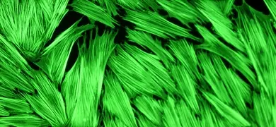 Green human colon fibroblasts.