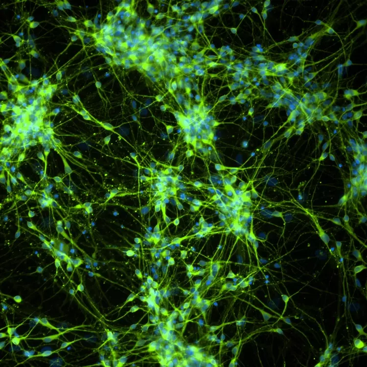 Green and blue dopaminergic neural progenitor cells