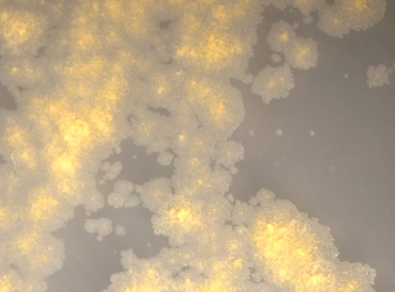 11758 Micrograph of colonies on ATCC Medium #173