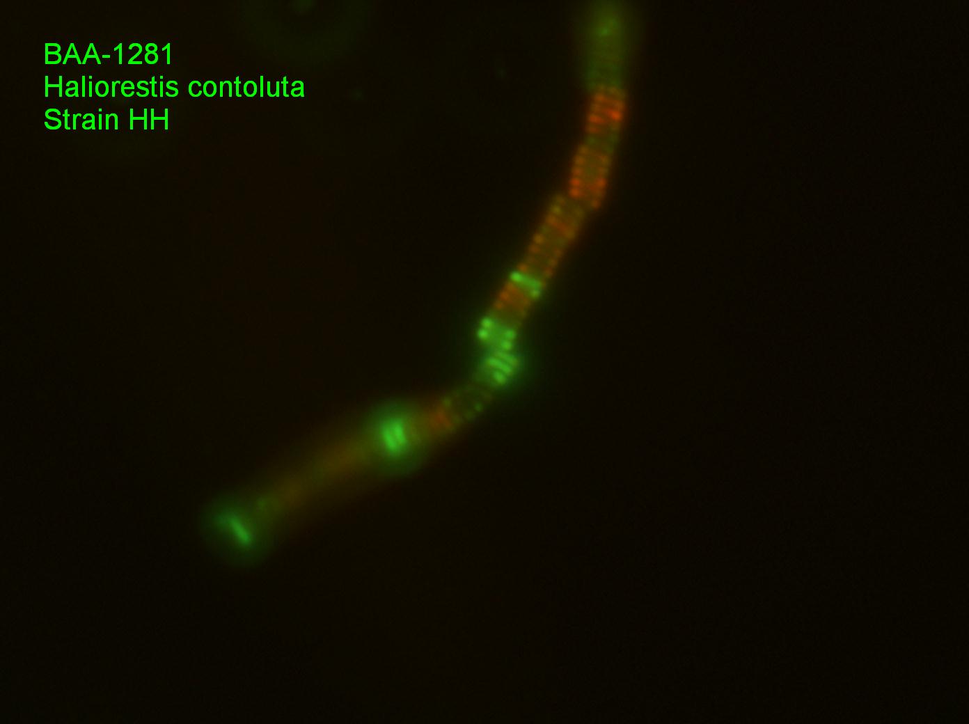 ATCC BAA-1281 Micrograph