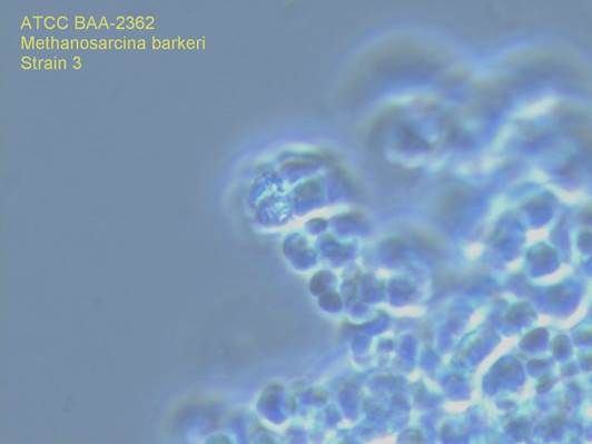 BAA-2362 Micrograph of Cells at 1000X